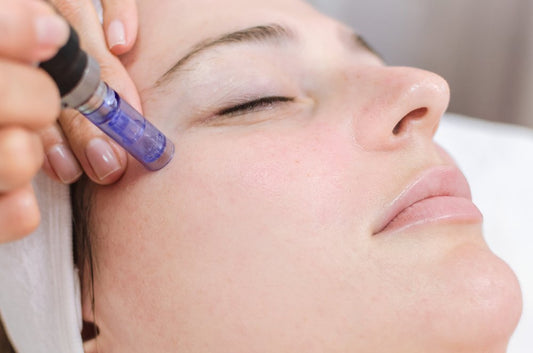 Who is suitable for micro needling?