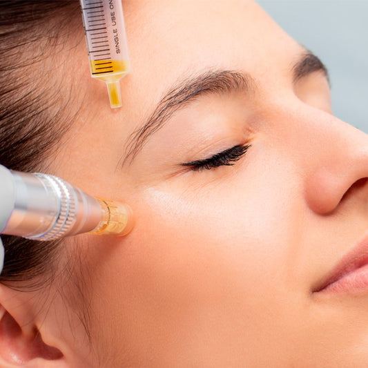 Why is Micro needling Effective with All Skin Types?