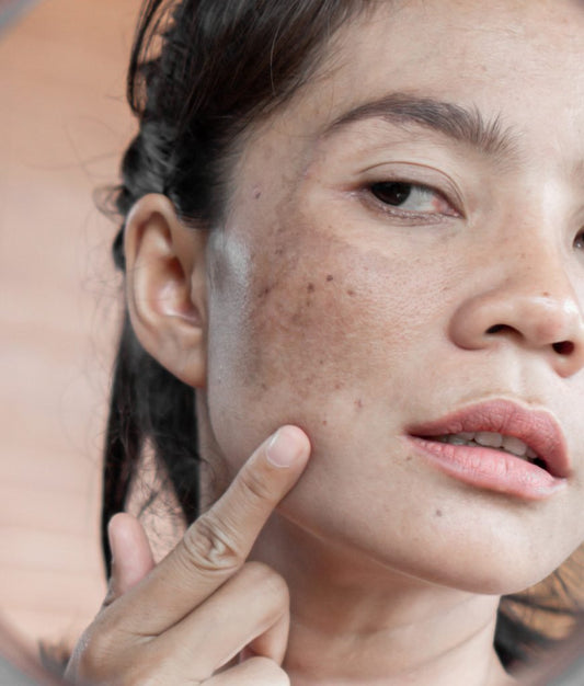 How to Spot Signs of Sun Damage
