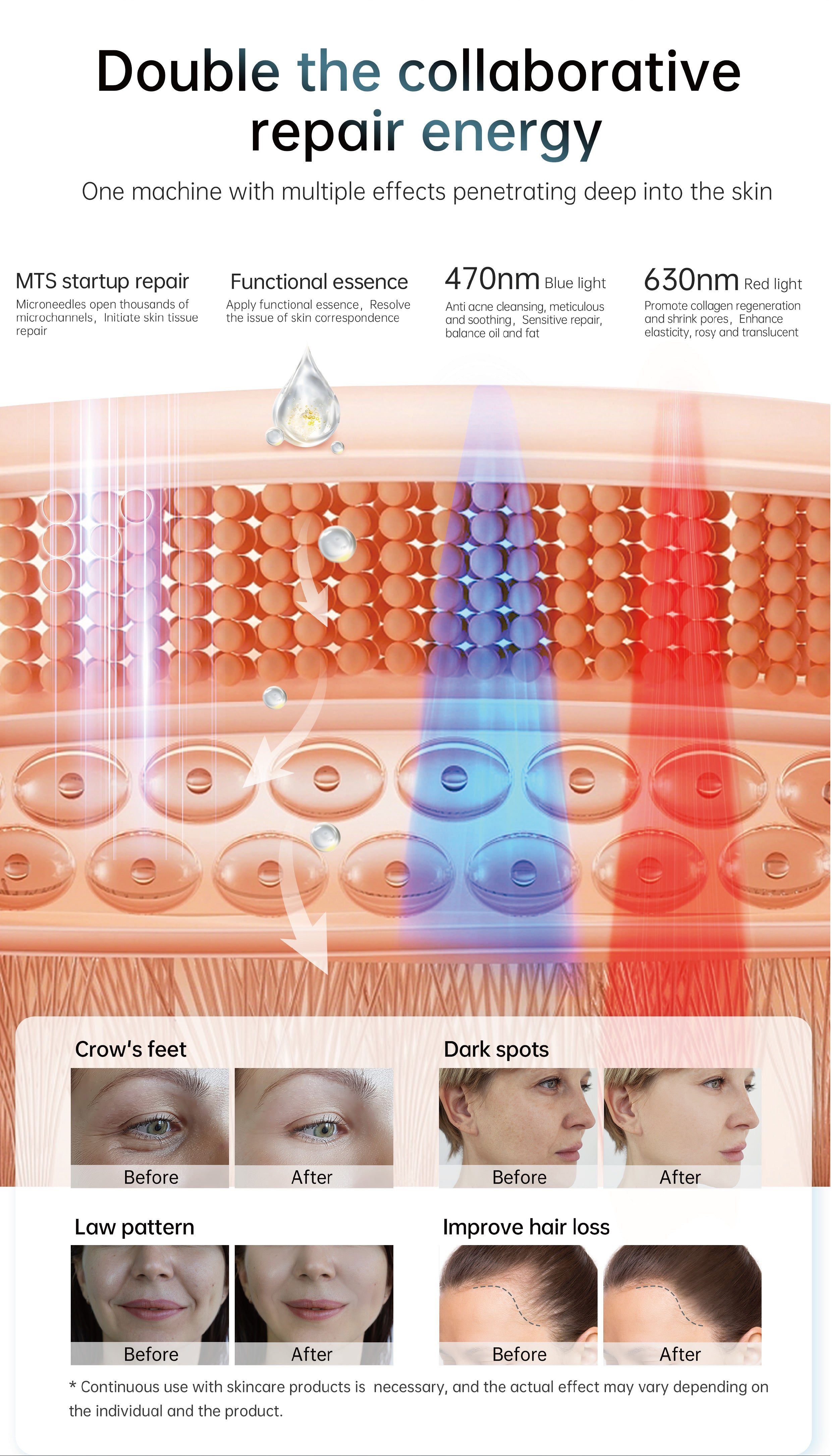 Hydra Pen H6 Advanced Serum Infusion Microneedling Pen with Light Therapy